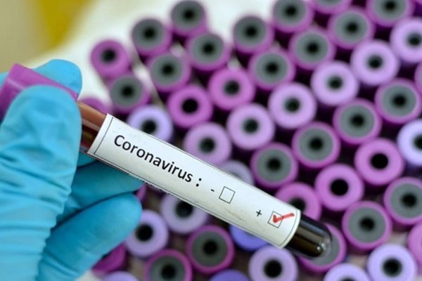 Αυστραλοί επιστήμονες ισχυρίζονται ότι βρήκαν μια θεραπεία για τον κορωνoϊό και ελπίζουν να ξεκινήσουν τις κλινικές δοκιμές έως το τέλος του μήνα. | Κορωνoϊός Ειδήσεις