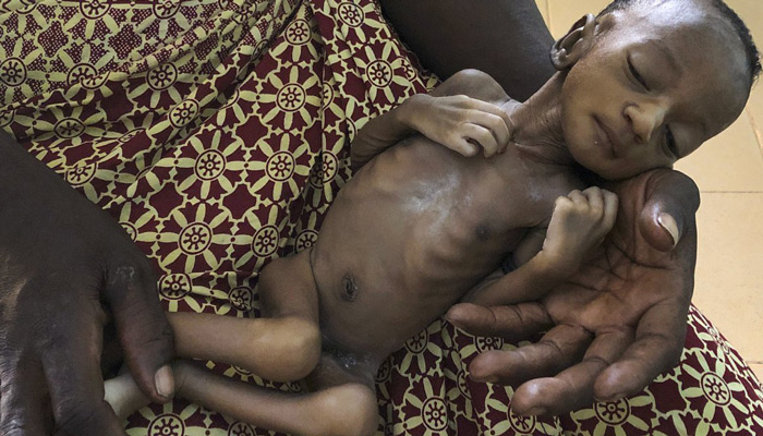 UNICEF: Εκατομμύρια παιδιά στην Υεμένη κινδυνεύουν να λιμοκτονήσουν